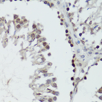 Anti-Phospho-MAPK14-Y182 Antibody (CABP0057)