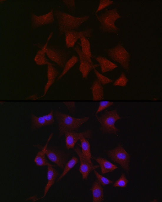 Anti-PRKCB Antibody (CAB13628)