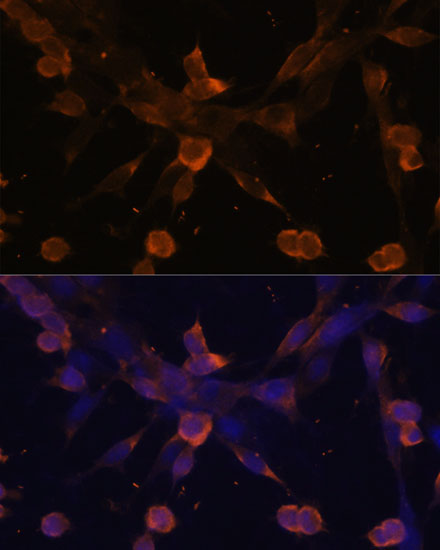 Anti-TGFBR2 Antibody (CAB1415)