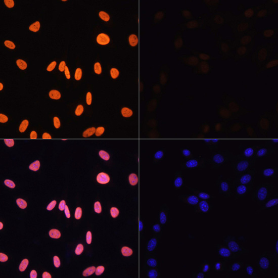 Anti-Acetyl-Histone H3-K4 Antibody (CAB16078)