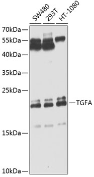 Anti-TGFA Antibody (CAB0337)