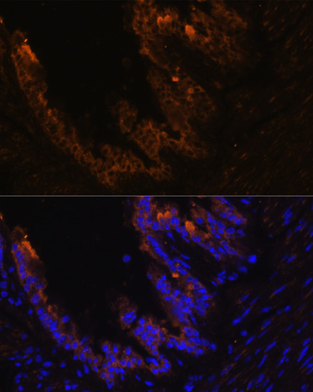 Anti-KRT7 Antibody (CAB2574)