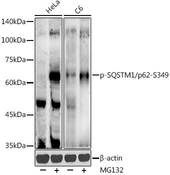 Western blot analysis of extracts of various cell lines, using Phospho-SQSTM1/p62-S349 antibody at 1:500 dilution. HeLa cells and C6 cells were treated by MG132(50 Î¼M) at 37â„ƒ for 90 minutes. Secondary antibody: HRP Goat Anti-Rabbit IgG (H+L) at 1:10000 dilution. Lysates/proteins: 25ug per lane. Blocking buffer: 3% nonfat dry milk in TBST. Detection: ECL Enhanced Kit. Exposure time: 90s.