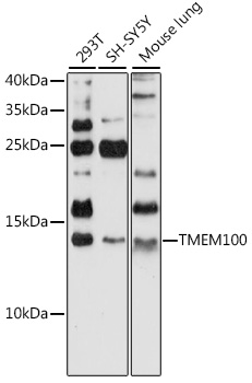 Anti-TMEM100 Antibody (CAB16653)