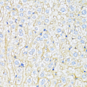 Anti-ABCA6 Antibody (CAB3191)