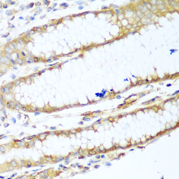 Anti-MYH9 Antibody (CAB0173)