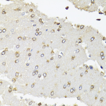 Anti-POLR2B Antibody (CAB5928)