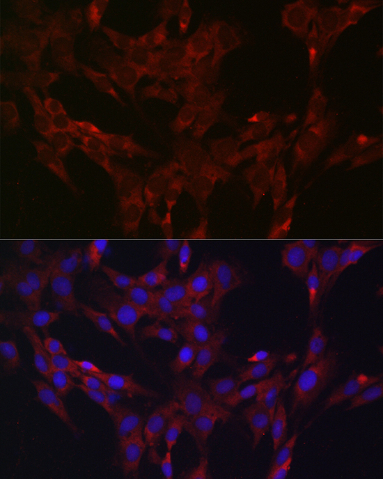 Anti-DUSP6 Antibody (CAB3171)