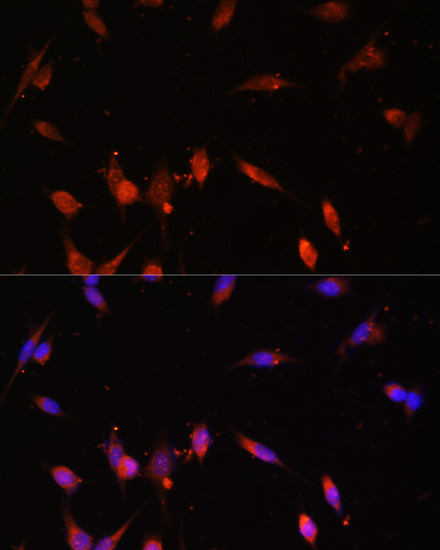 Anti-PIK3R3 Antibody (CAB17322)