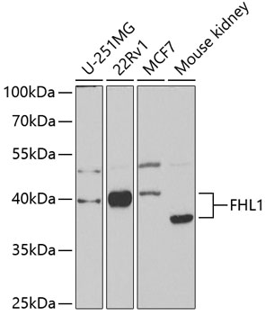 Anti-FHL1 Antibody (CAB5460)