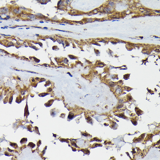 Anti-TARBP2 Antibody (CAB7533)