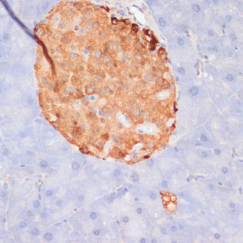 Anti-Phospho-ACLY-S455 pAb (CABP0779)