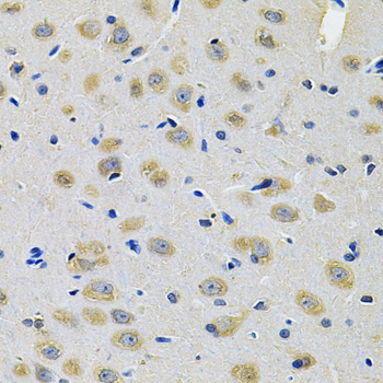 Anti-TXNDC5 Antibody (CAB14152)