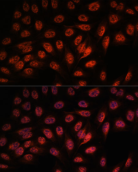 Anti-RBM25 Antibody (CAB15496)