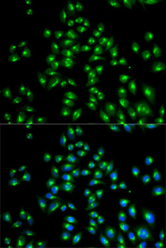 Anti-USO1 Antibody (CAB2796)