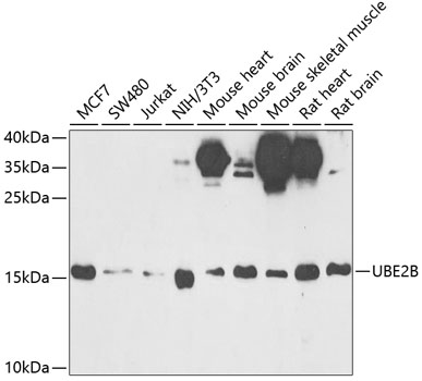 Anti-UBE2B Antibody (CAB6315)