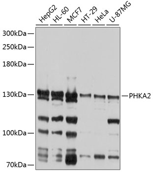 Anti-PHKA2 Polyclonal Antibody (CAB9636)