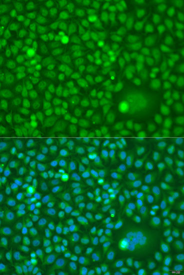 Anti-CDK10 Antibody (CAB2690)