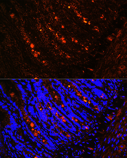 Anti-ITLN1 Antibody (CAB7234)