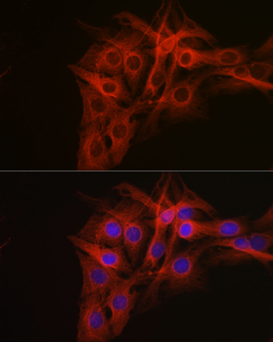 Anti-Beta-Tubulin Antibody (CABC008)