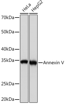Anti-Annexin V Antibody (CAB9262)