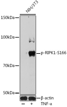 Anti-Phospho-RIPK1-S166 Antibody (CABP1115)