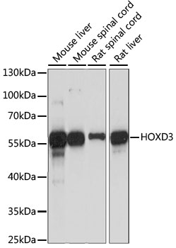 Anti-HOXD3 Antibody (CAB15279)