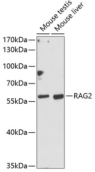 Anti-RAG2 Antibody (CAB12488)