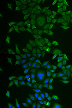 Anti-CCBL1 Antibody (CAB6542)