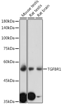 Anti-TGFBR1 Antibody (CAB0708)