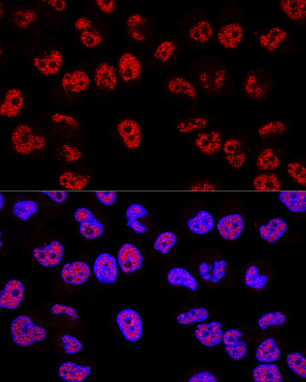 Anti-p53 Antibody (CAB0263)