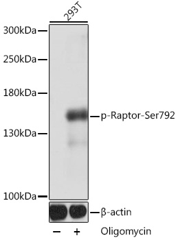 Anti-Phospho-Raptor-Ser792 Antibody (CABP0928)