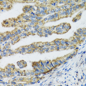 Anti-TXN2 Antibody (CAB6782)