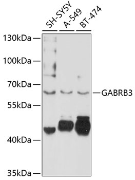 Anti-GABRB3 Antibody (CAB10015)