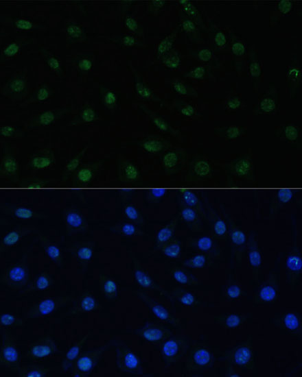 Anti-PELP1 Antibody (CAB3189)