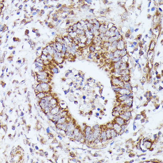 Anti-DLAT Antibody (CAB14530)