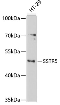 Anti-SSTR5 Antibody (CAB3136)