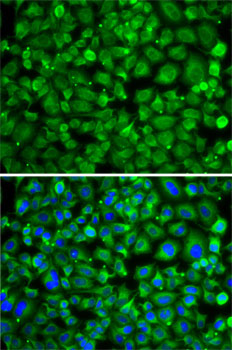 Anti-SAT2 Antibody (CAB7211)