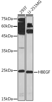 Anti-HBEGF Antibody (CAB16365)