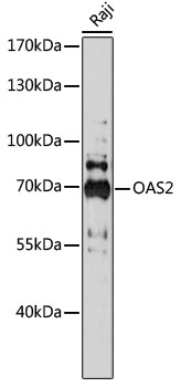 Anti-OAS2 Antibody (CAB17428)