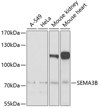 Anti-SEMA3B Antibody (CAB7004)