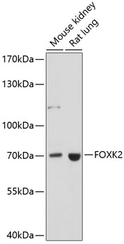 Anti-FOXK2 Antibody (CAB14245)