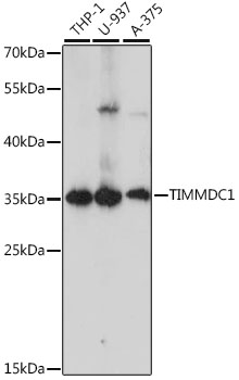 Anti-TIMMDC1 Antibody (CAB15839)