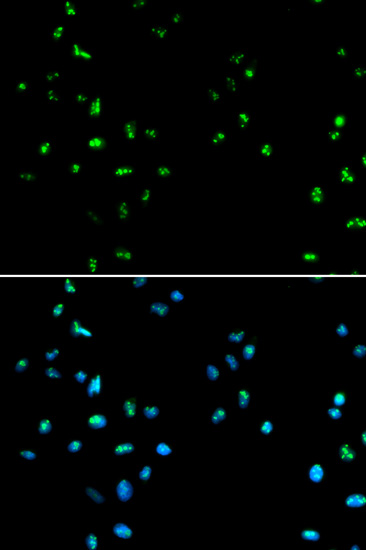 Anti-HDAC4 Antibody (CAB0239)