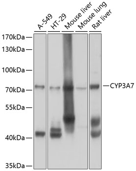 Anti-CYP3A7 Antibody (CAB10026)