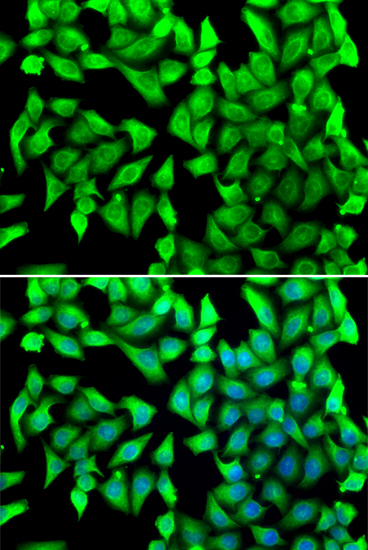 Anti-VTI1B Antibody (CAB7062)