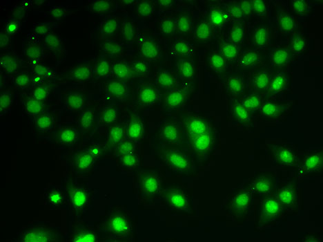 Anti-HDAC5 Antibody (CAB0632)