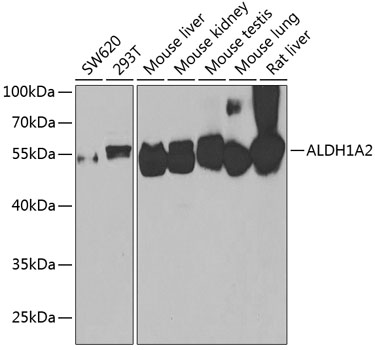Anti-ALDH1A2 Antibody (CAB7503)
