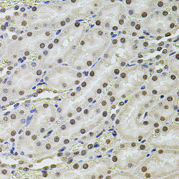 Anti-SET Antibody (CAB12502)