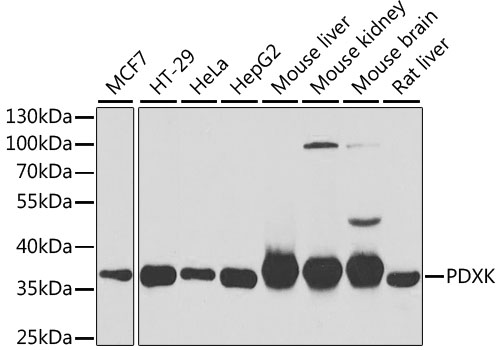 Anti-PDXK Antibody (CAB6687)